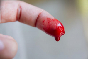 Top 6 Cách cầm máu tại nhà với vết thương nhẹ hiệu quả nhất